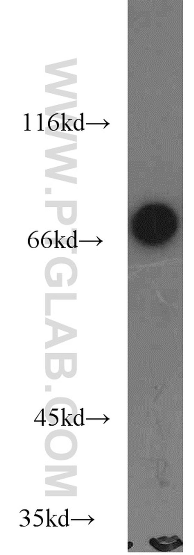 SLP76 Antibody in Western Blot (WB)