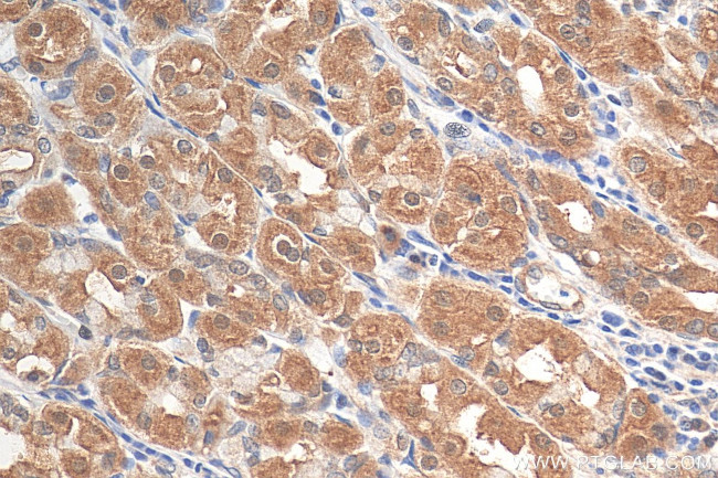 NET1 Antibody in Immunohistochemistry (Paraffin) (IHC (P))