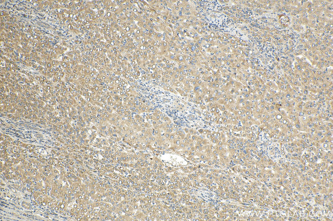 Complement factor H Antibody in Immunohistochemistry (Paraffin) (IHC (P))