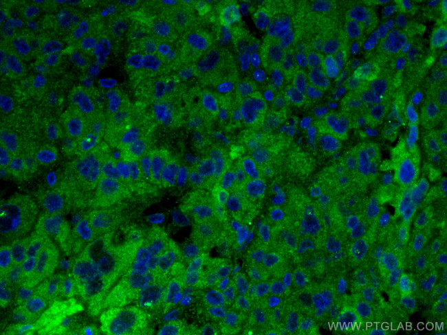 Complement factor H Antibody in Immunohistochemistry (PFA fixed) (IHC (PFA))