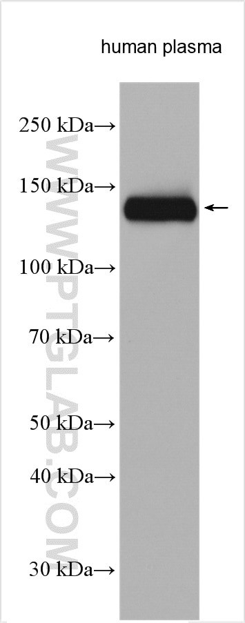 Complement factor H Antibody in Western Blot (WB)