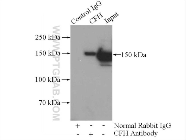 Complement factor H Antibody in Immunoprecipitation (IP)