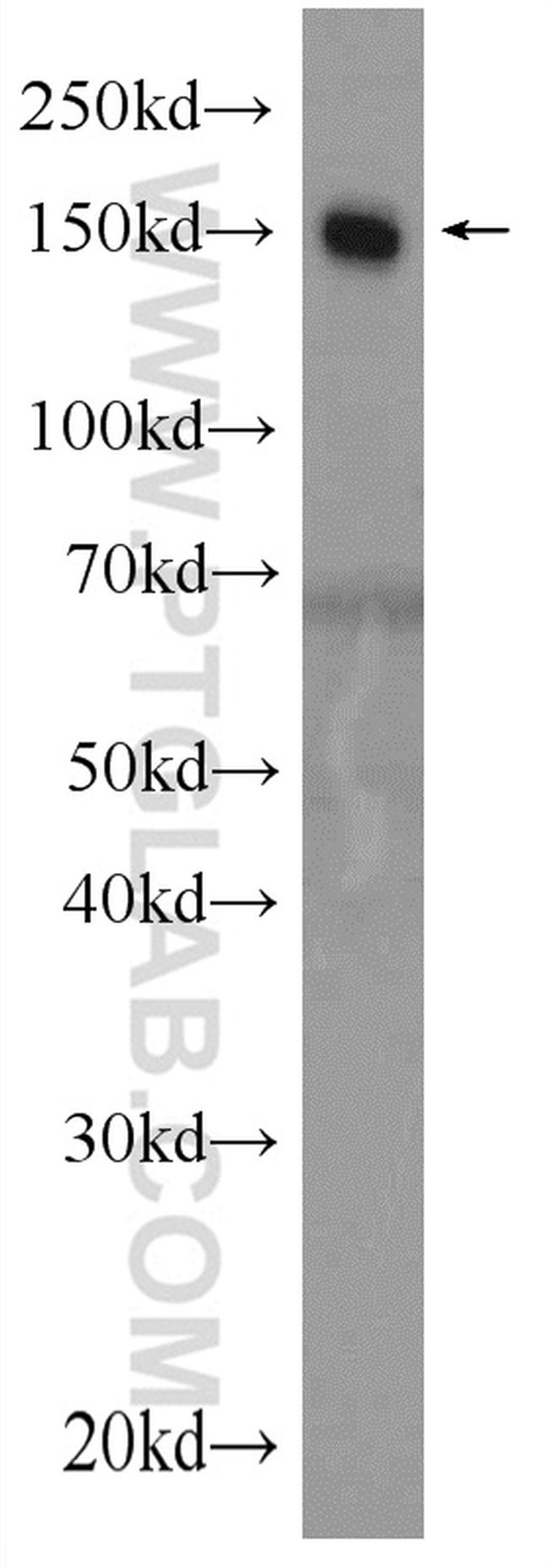 Complement factor H Antibody in Western Blot (WB)