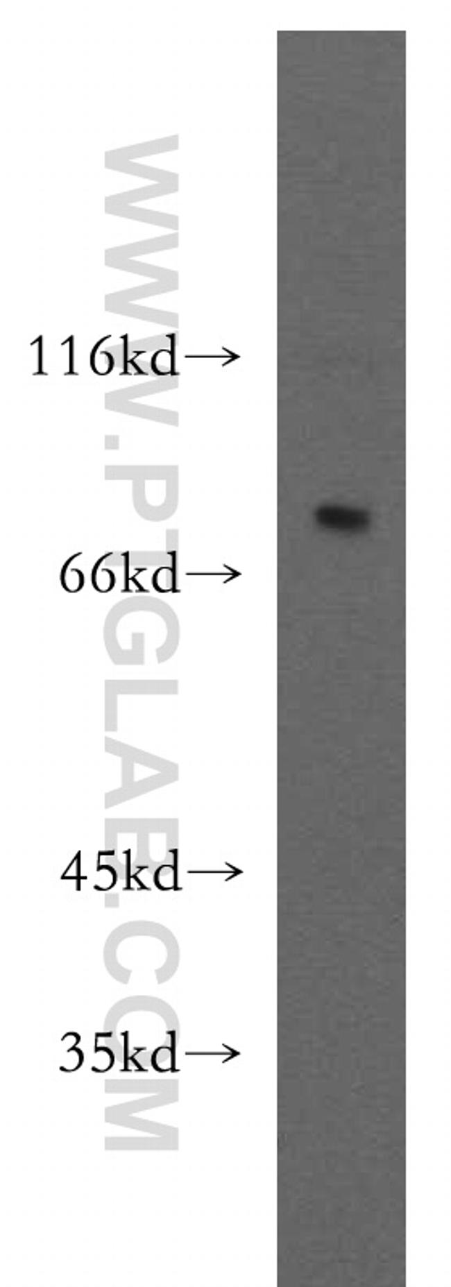 DPP8 Antibody in Western Blot (WB)