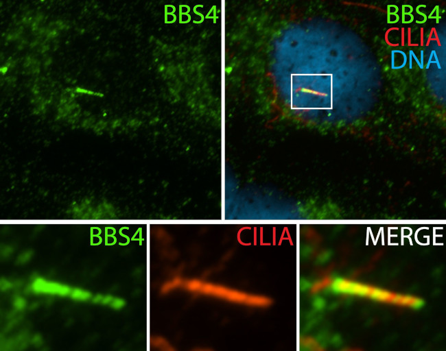 BBS4 Antibody in Immunocytochemistry (ICC/IF)