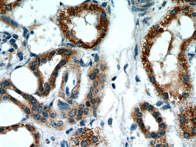 BBS4 Antibody in Immunohistochemistry (Paraffin) (IHC (P))