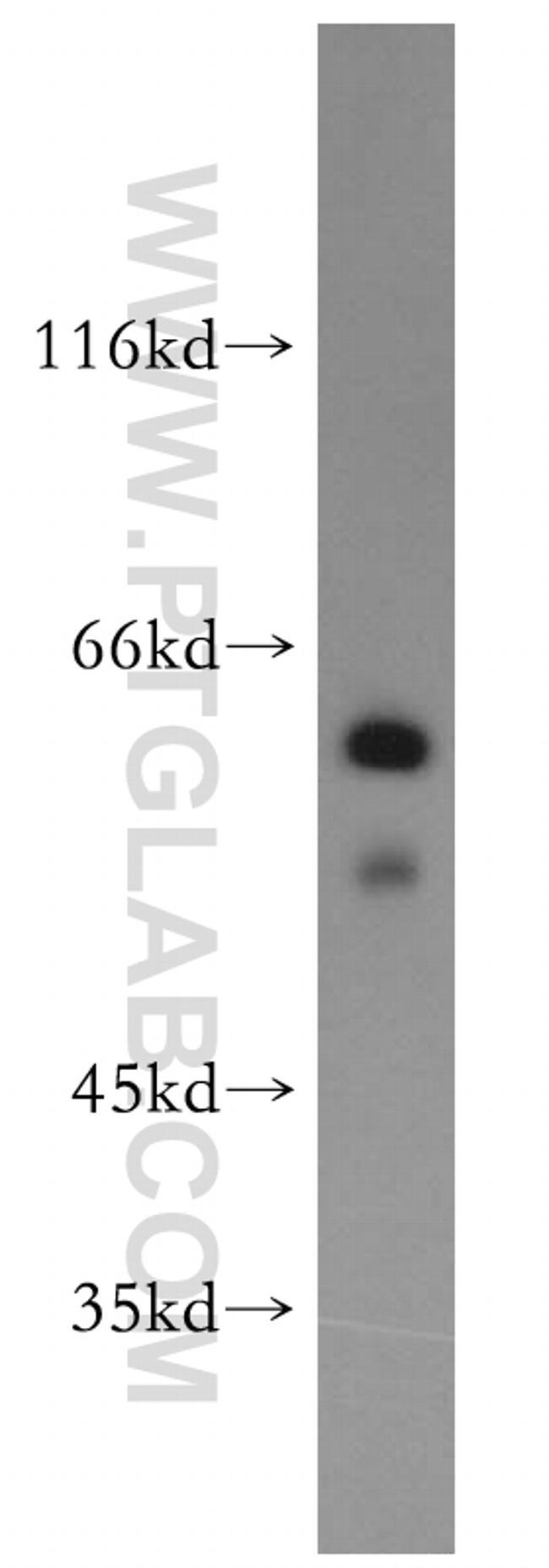 BBS4 Antibody in Western Blot (WB)