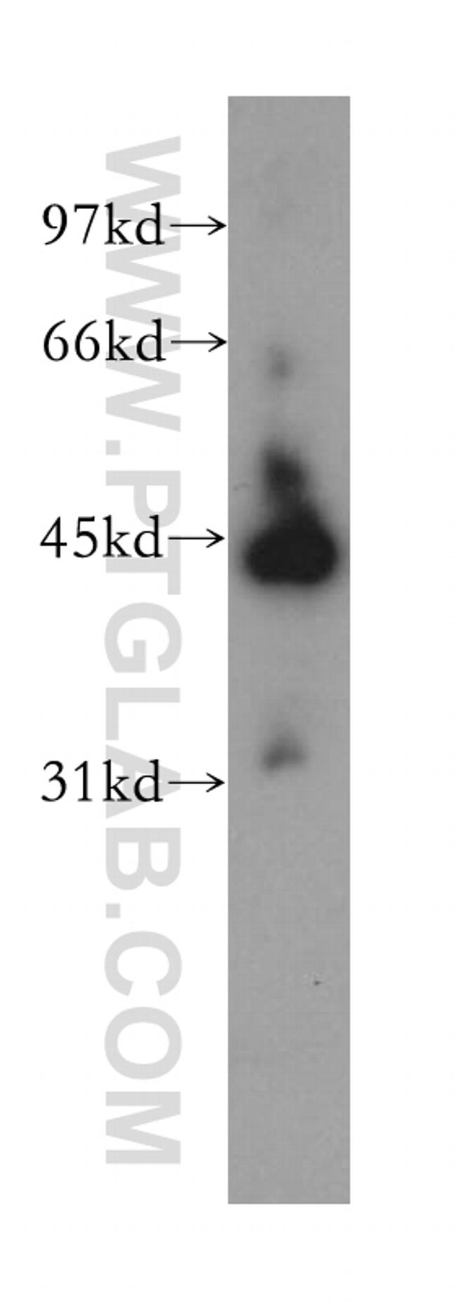 KRR1 Antibody in Western Blot (WB)