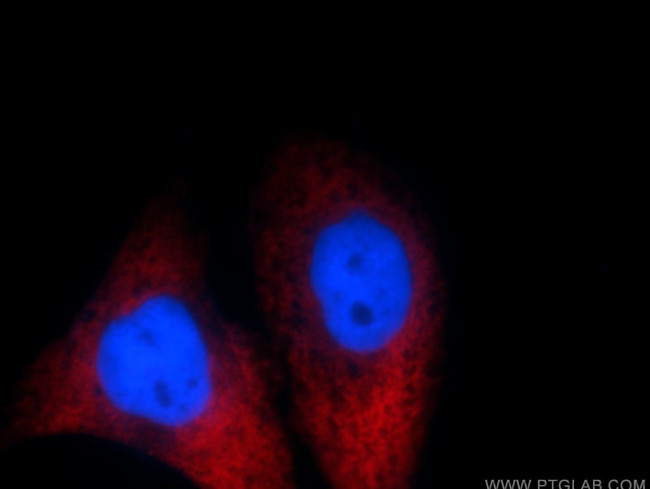 MAGEB4 Antibody in Immunocytochemistry (ICC/IF)