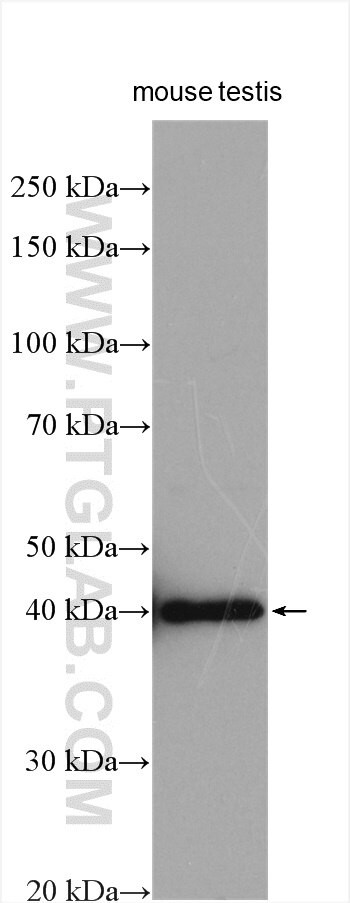 MAGEB4 Antibody in Western Blot (WB)