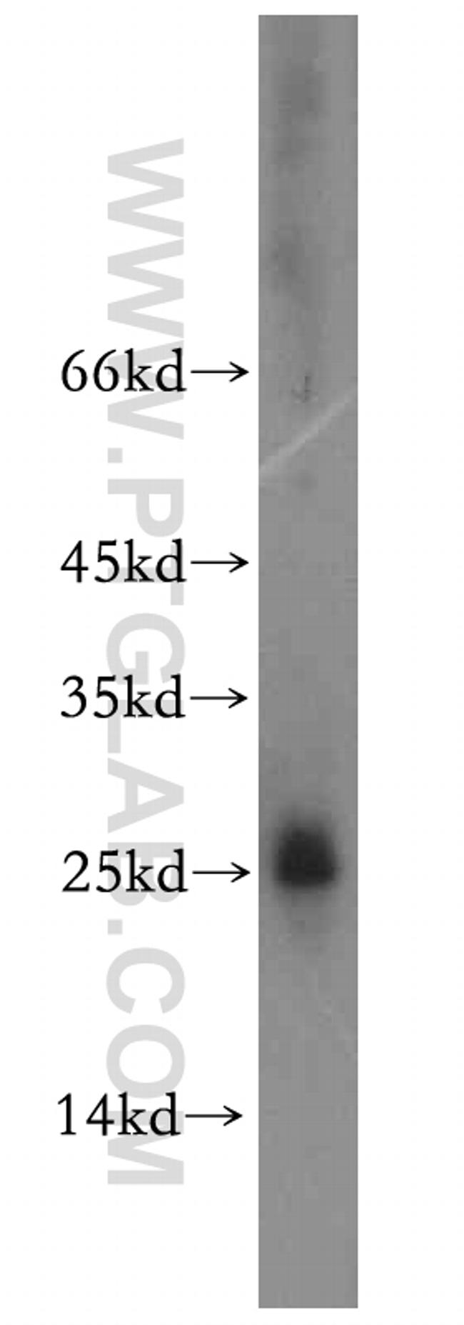 HMGB4 Antibody in Western Blot (WB)