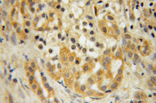 MOBKL1A Antibody in Immunohistochemistry (Paraffin) (IHC (P))