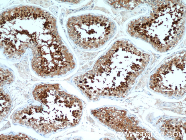 HSPA2 Antibody in Immunohistochemistry (Paraffin) (IHC (P))