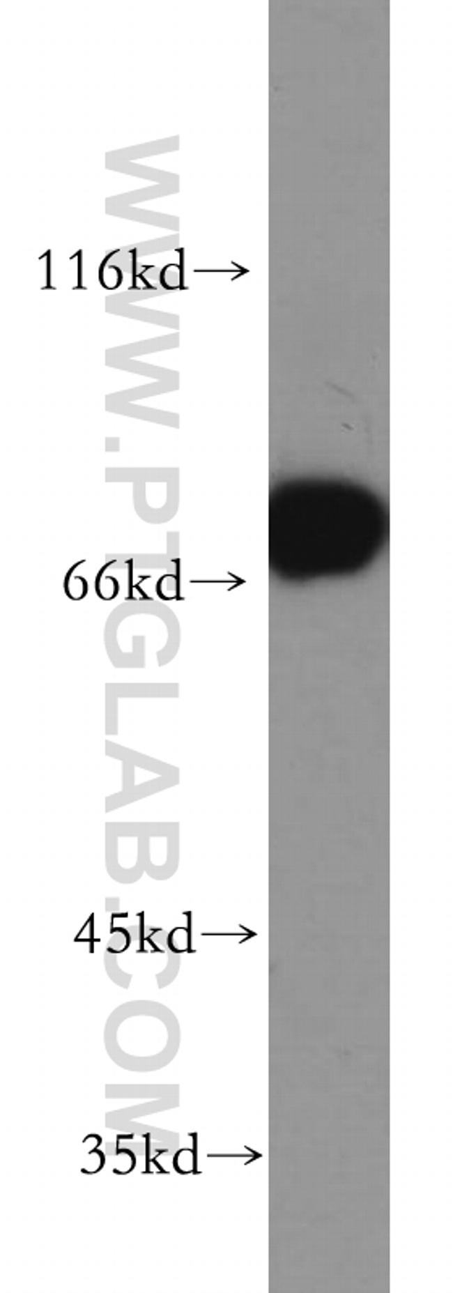 HSPA2 Antibody in Western Blot (WB)