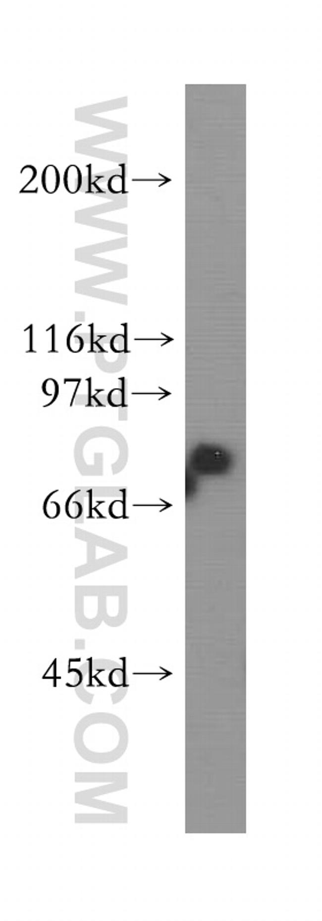 HSPA2 Antibody in Western Blot (WB)