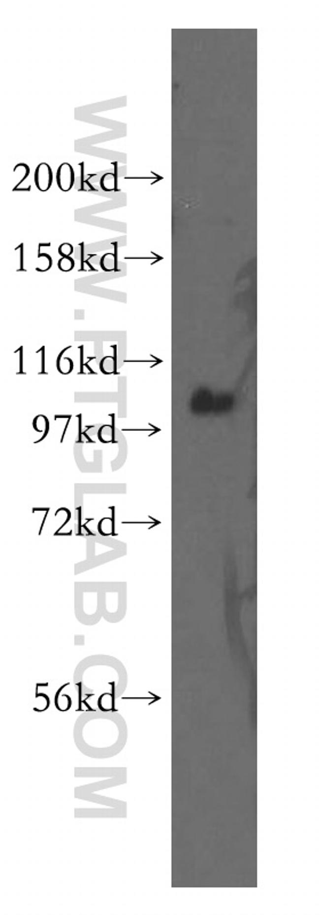 ITPKB Antibody in Western Blot (WB)