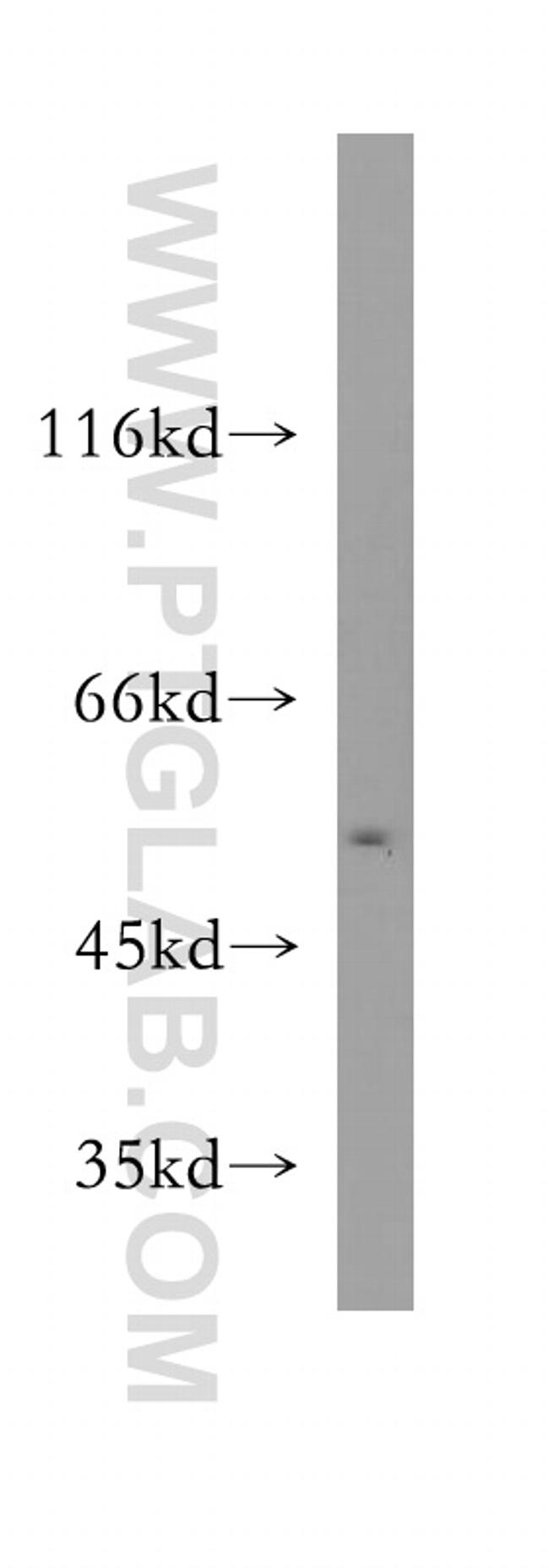 SMARCD3 Antibody in Western Blot (WB)