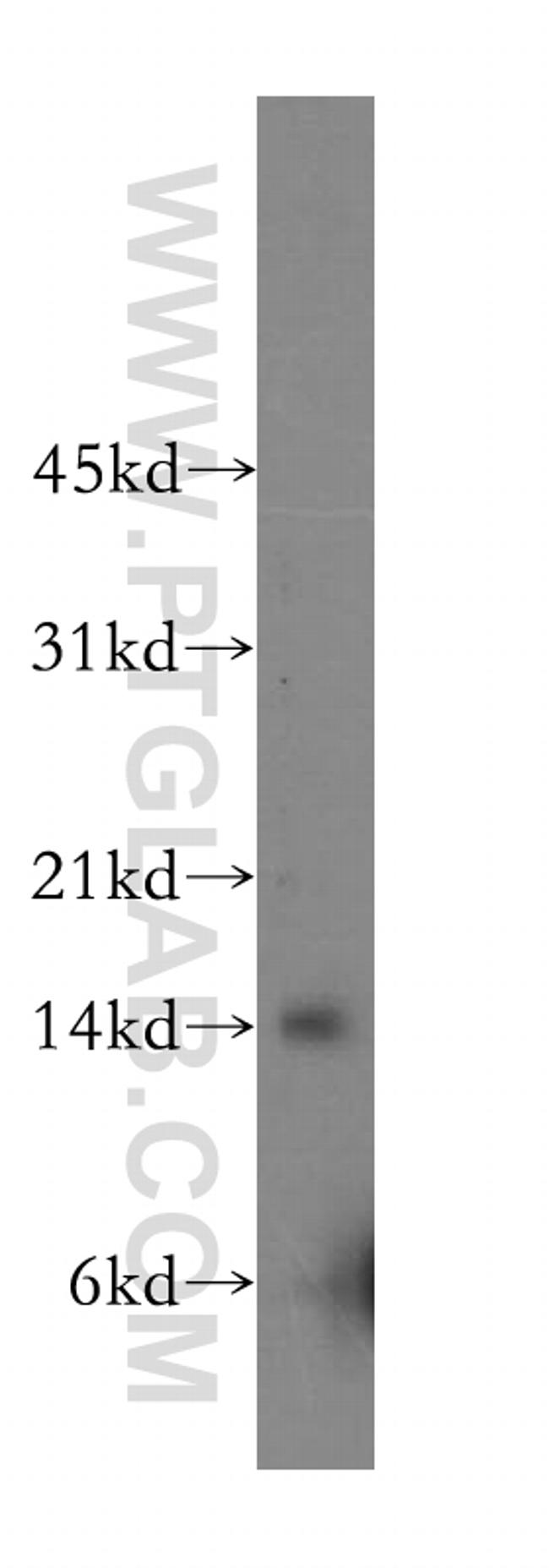 Galectin 2 Antibody in Western Blot (WB)