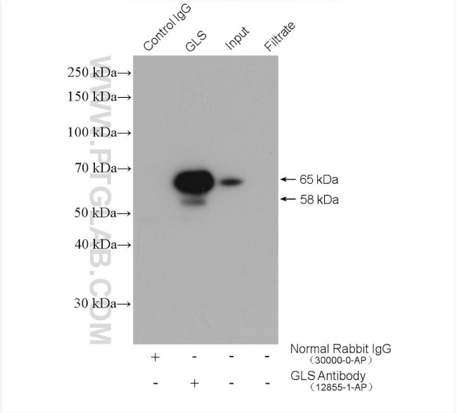 KGA/GAC Antibody in Immunoprecipitation (IP)