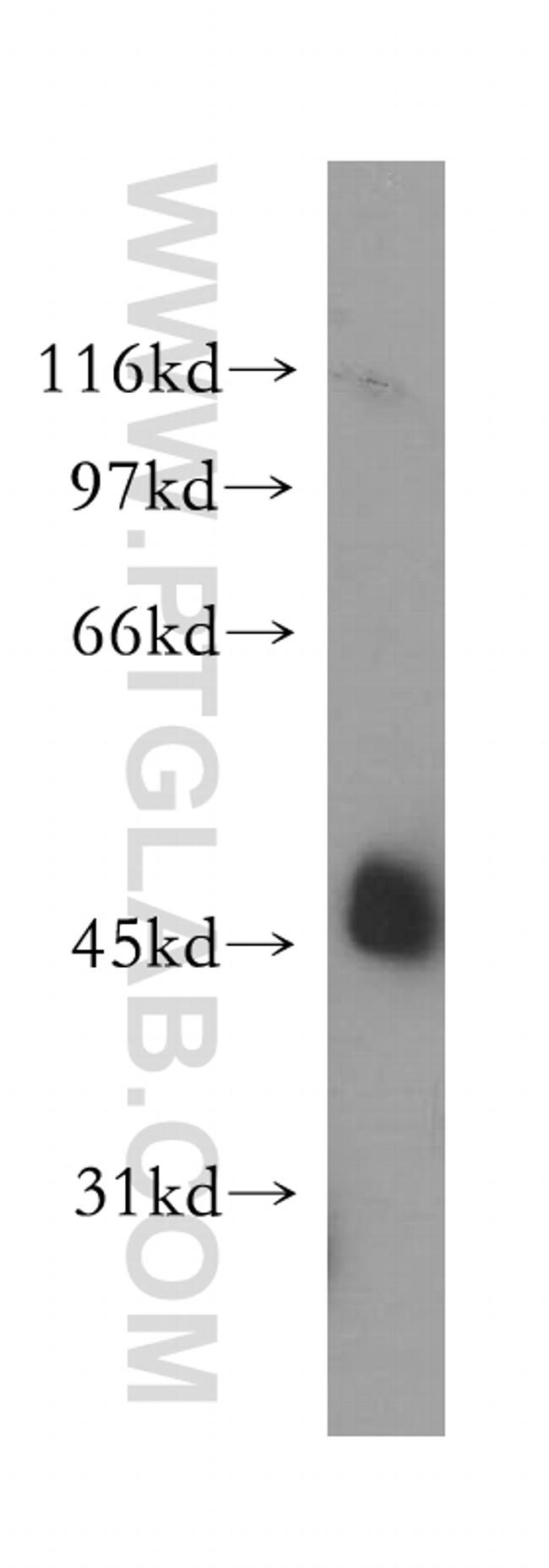 STOML1 Antibody in Western Blot (WB)