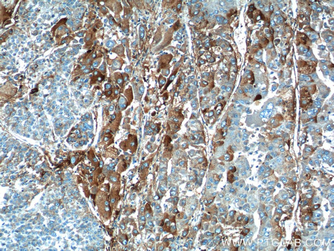 HABP2 Antibody in Immunohistochemistry (Paraffin) (IHC (P))