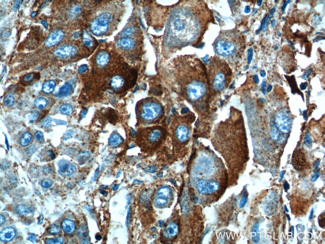 HABP2 Antibody in Immunohistochemistry (Paraffin) (IHC (P))