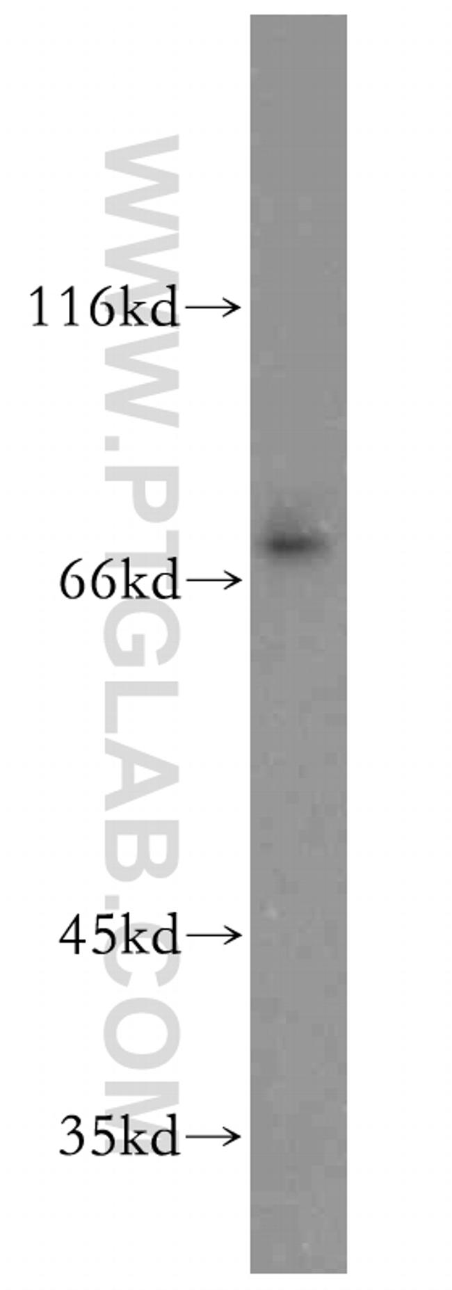 EAAT4 Antibody in Western Blot (WB)