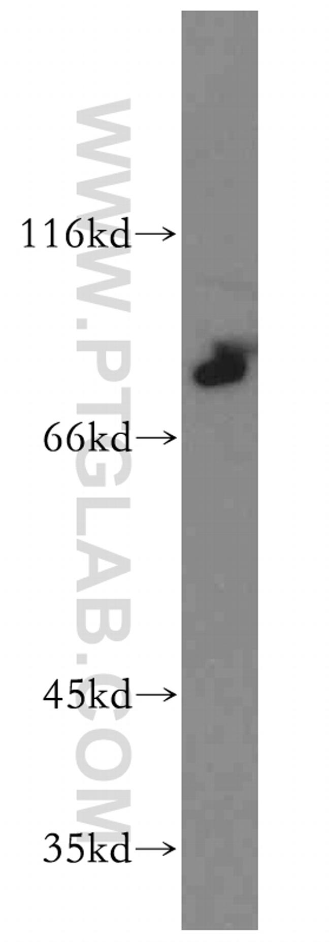 ST5 Antibody in Western Blot (WB)