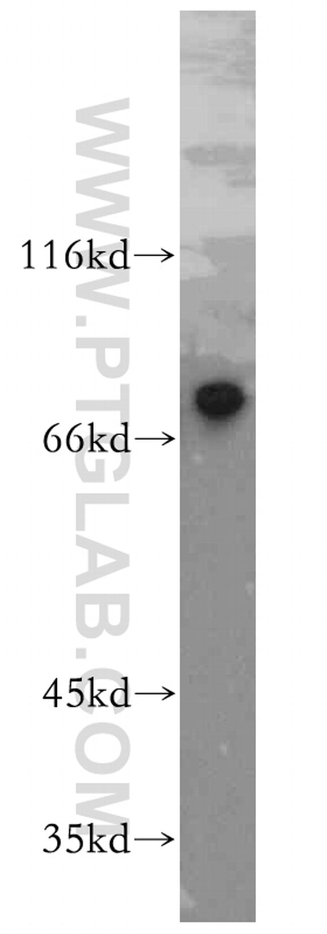 ST5 Antibody in Western Blot (WB)