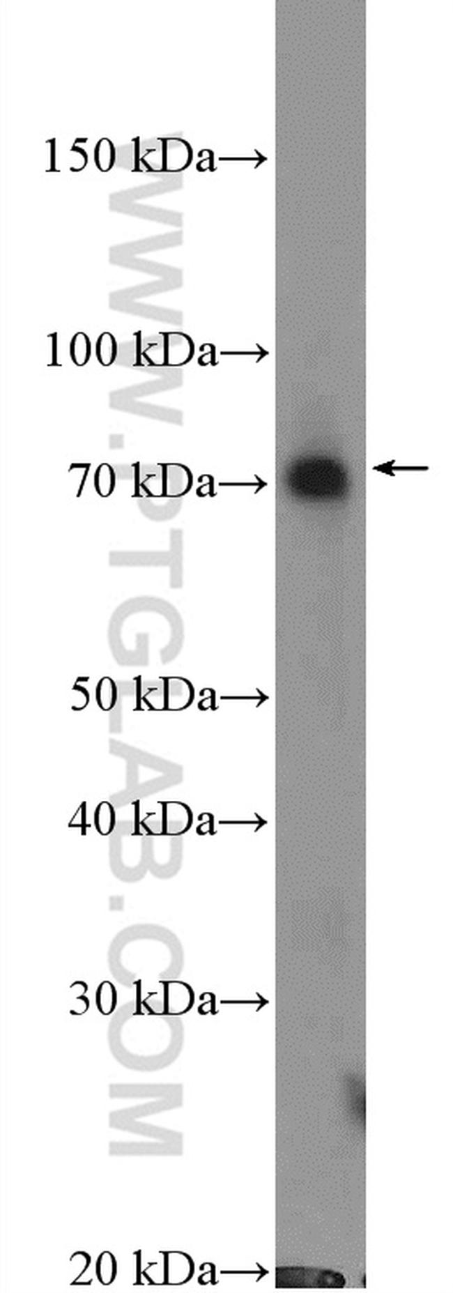 RPN1 Antibody in Western Blot (WB)