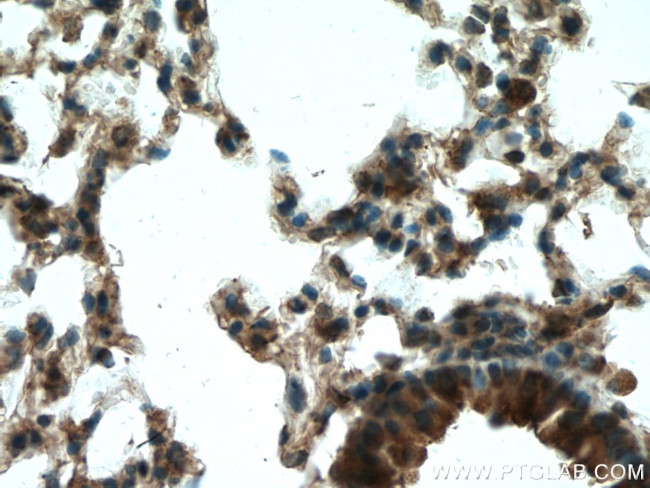 RPN1 Antibody in Immunohistochemistry (Paraffin) (IHC (P))