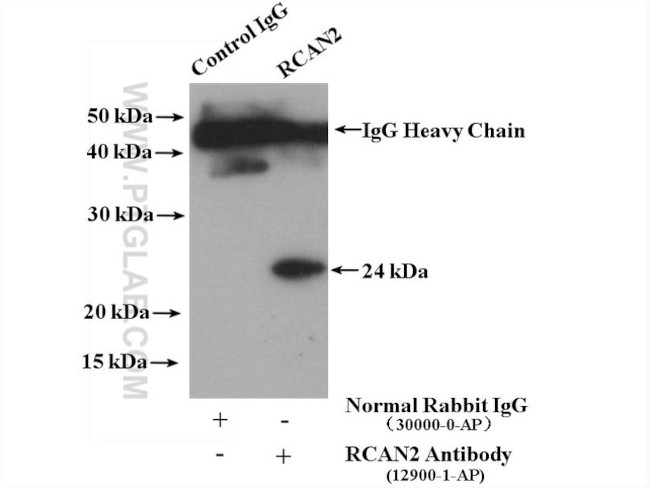 RCAN2 Antibody in Immunoprecipitation (IP)