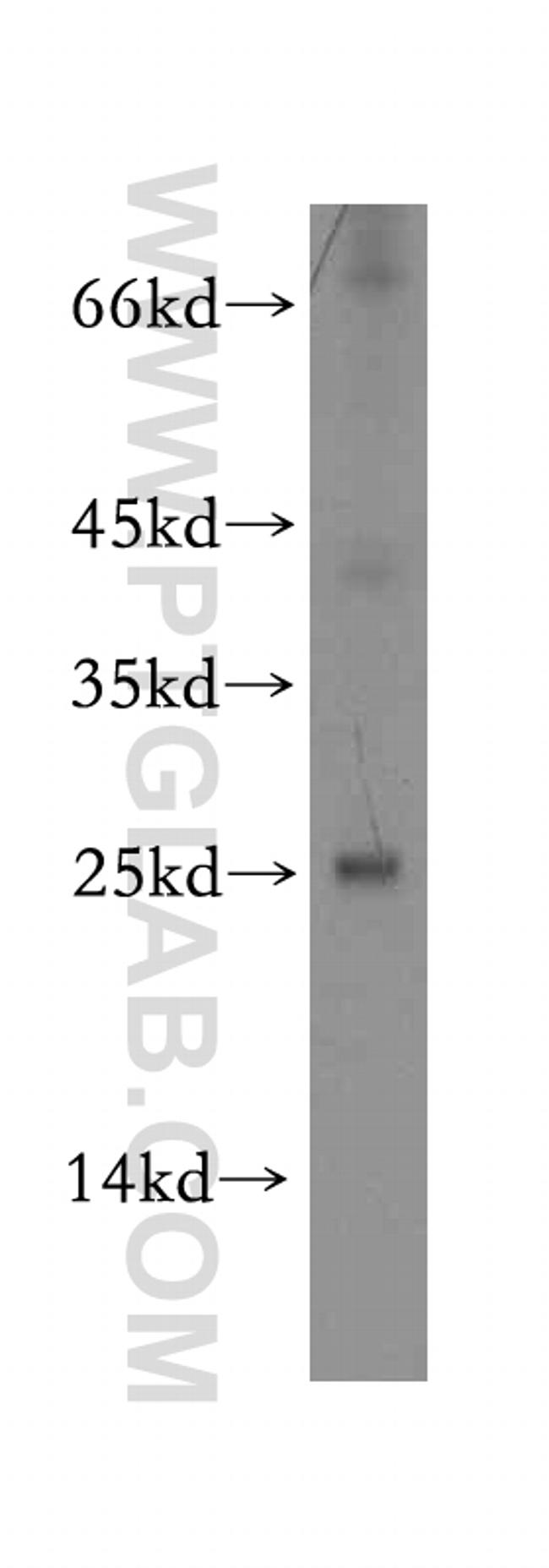RCAN2 Antibody in Western Blot (WB)