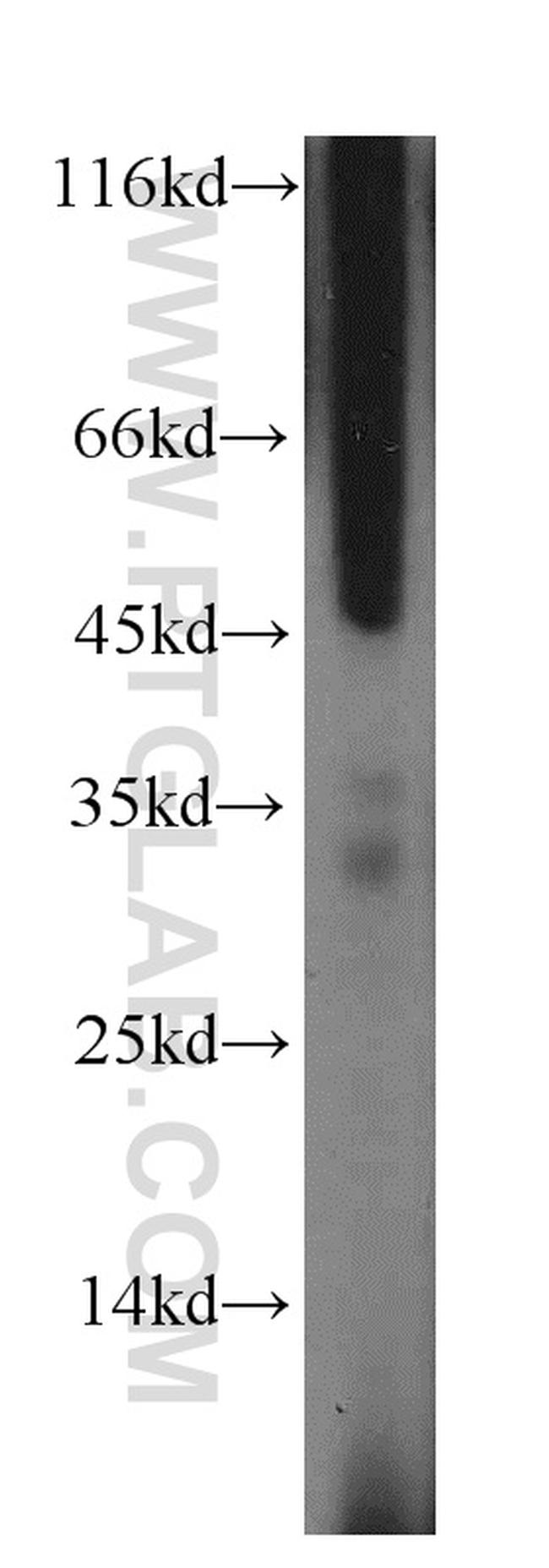 RCAN2 Antibody in Western Blot (WB)