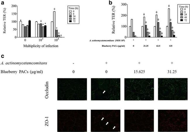 Occludin Antibody in Immunocytochemistry (ICC/IF)