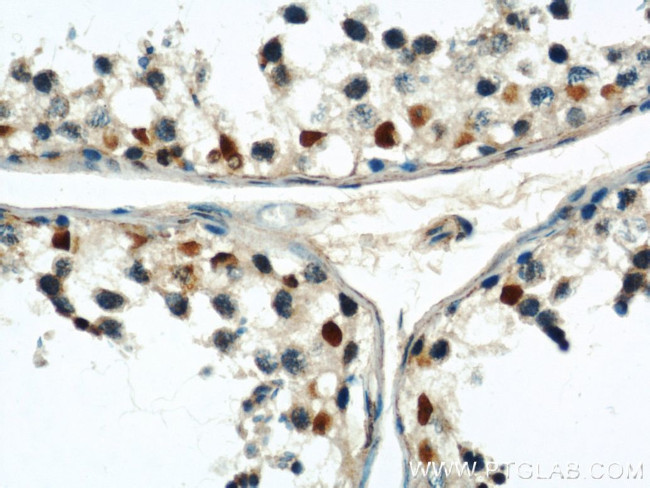 CUL4B Antibody in Immunohistochemistry (Paraffin) (IHC (P))