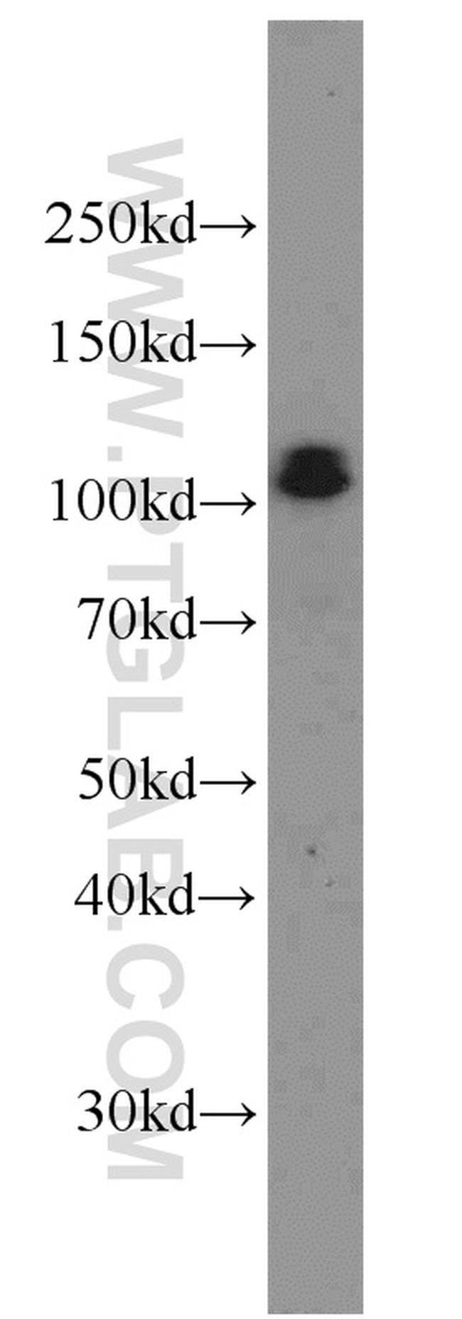 CUL4B Antibody in Western Blot (WB)