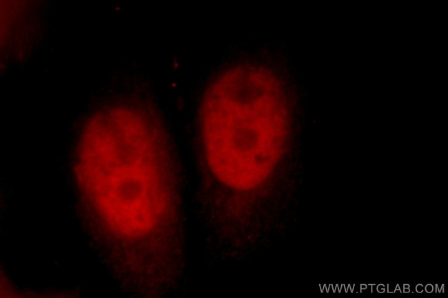 CUL4B Antibody in Immunocytochemistry (ICC/IF)