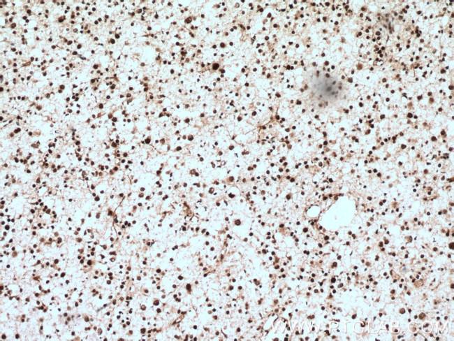 CUL4B Antibody in Immunohistochemistry (Paraffin) (IHC (P))