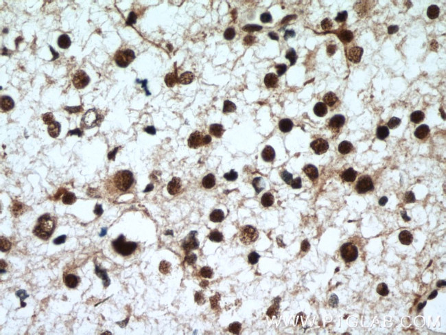 CUL4B Antibody in Immunohistochemistry (Paraffin) (IHC (P))