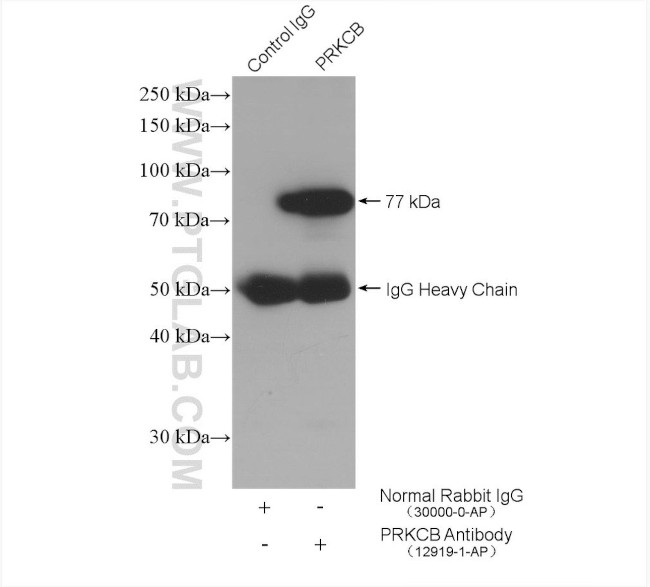 PKC beta Antibody in Immunoprecipitation (IP)