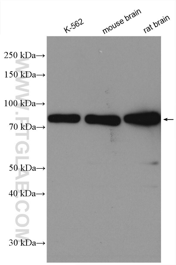 PKC beta Antibody in Western Blot (WB)