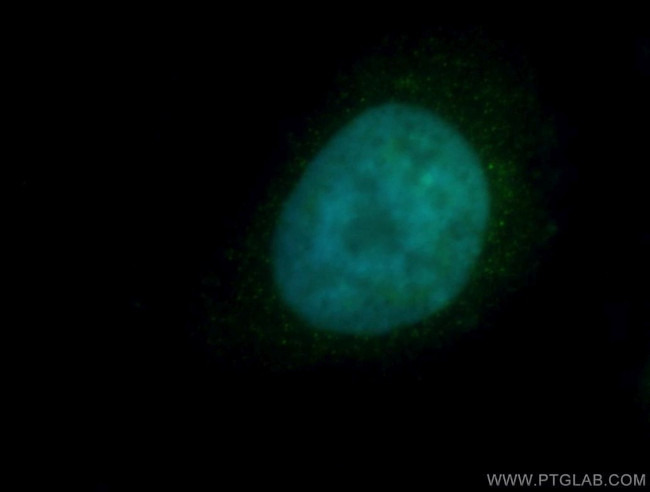 HDAC2 Antibody in Immunocytochemistry (ICC/IF)