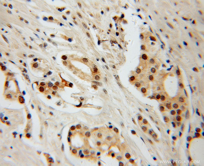 HDAC2 Antibody in Immunohistochemistry (Paraffin) (IHC (P))