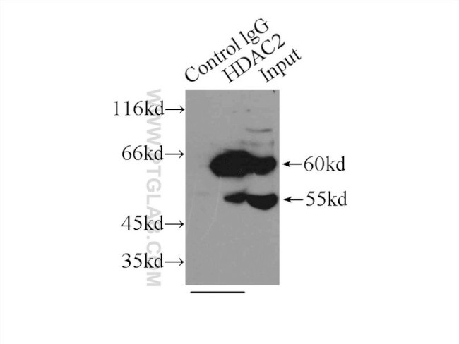 HDAC2 Antibody in Immunoprecipitation (IP)