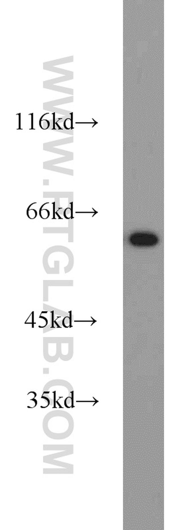 HDAC2 Antibody in Western Blot (WB)