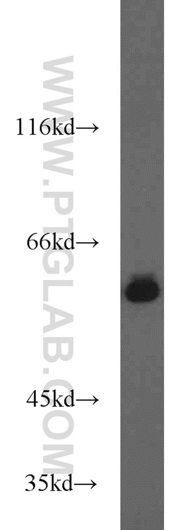 HDAC2 Antibody in Western Blot (WB)