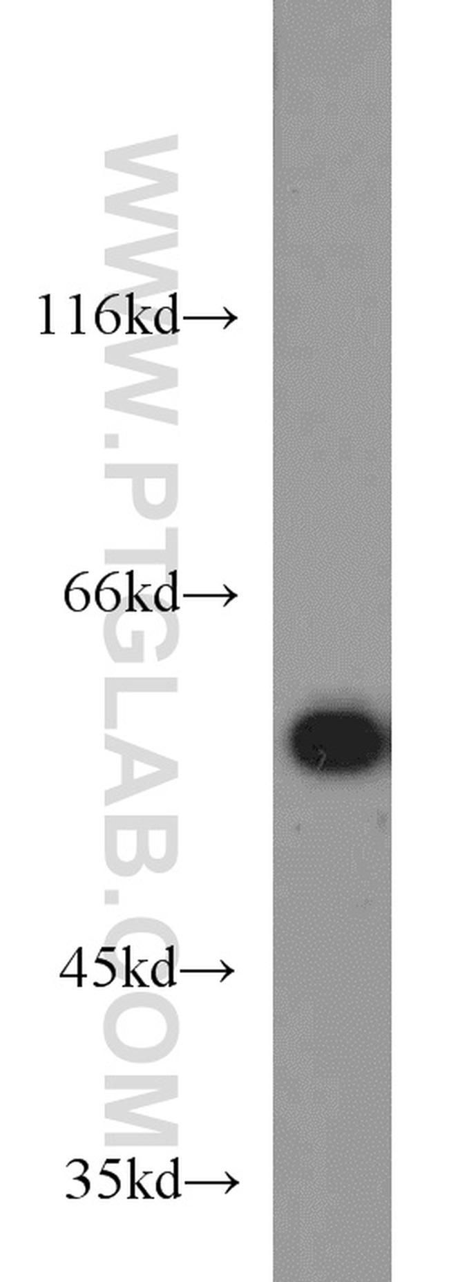 HDAC2 Antibody in Western Blot (WB)