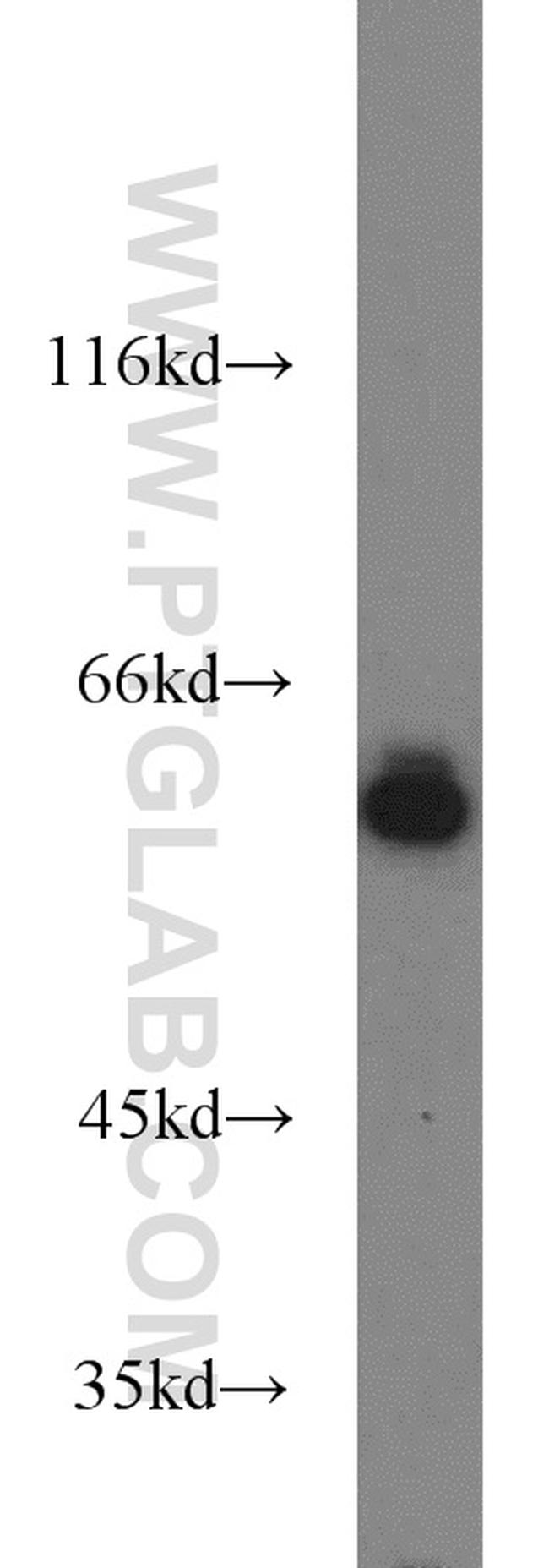 HDAC2 Antibody in Western Blot (WB)