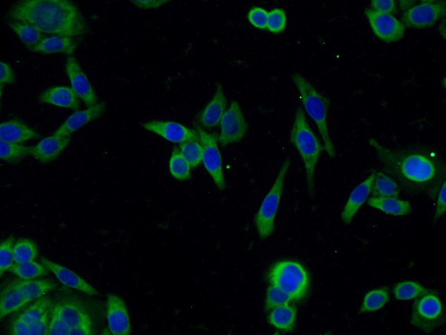 PLK4 Antibody in Immunocytochemistry (ICC/IF)